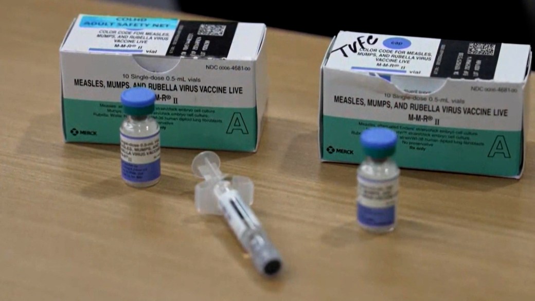 美国未接种麻疹疫苗的成人死亡,原因尚未确定